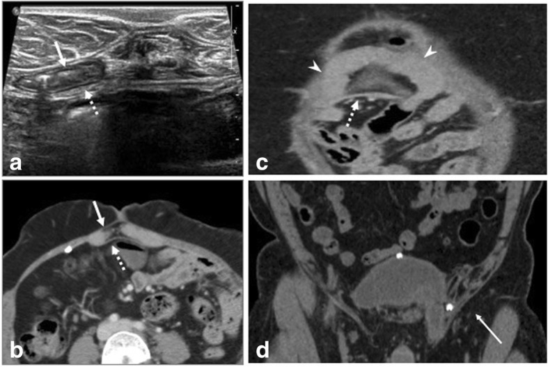 Fig. 10