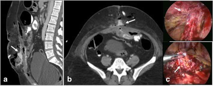 Fig. 13