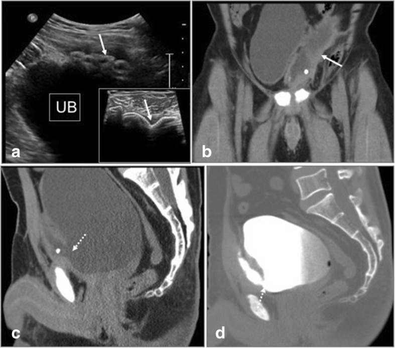 Fig. 15