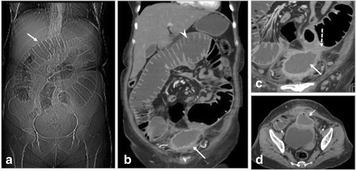 Fig. 14