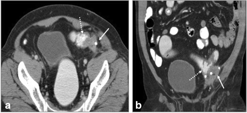 Fig. 11