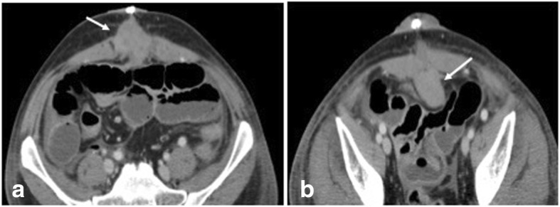 Fig. 6