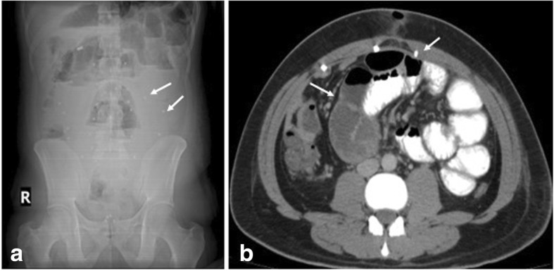 Fig. 1