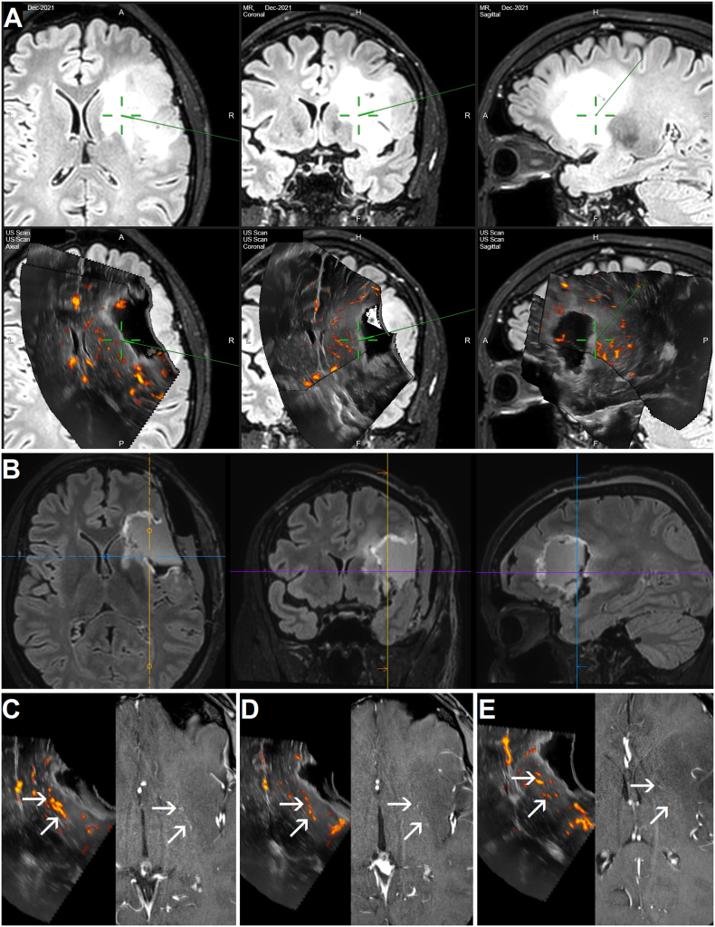 Fig. 1