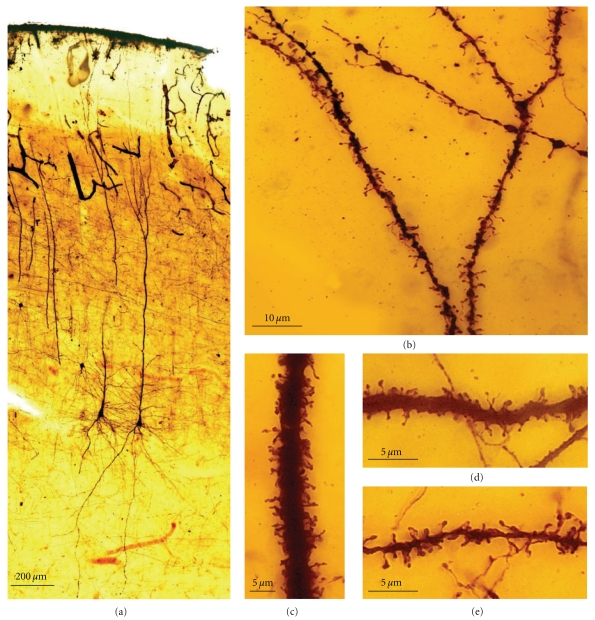 Figure 15