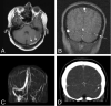 Fig 3.