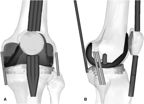 Fig. 2A–B