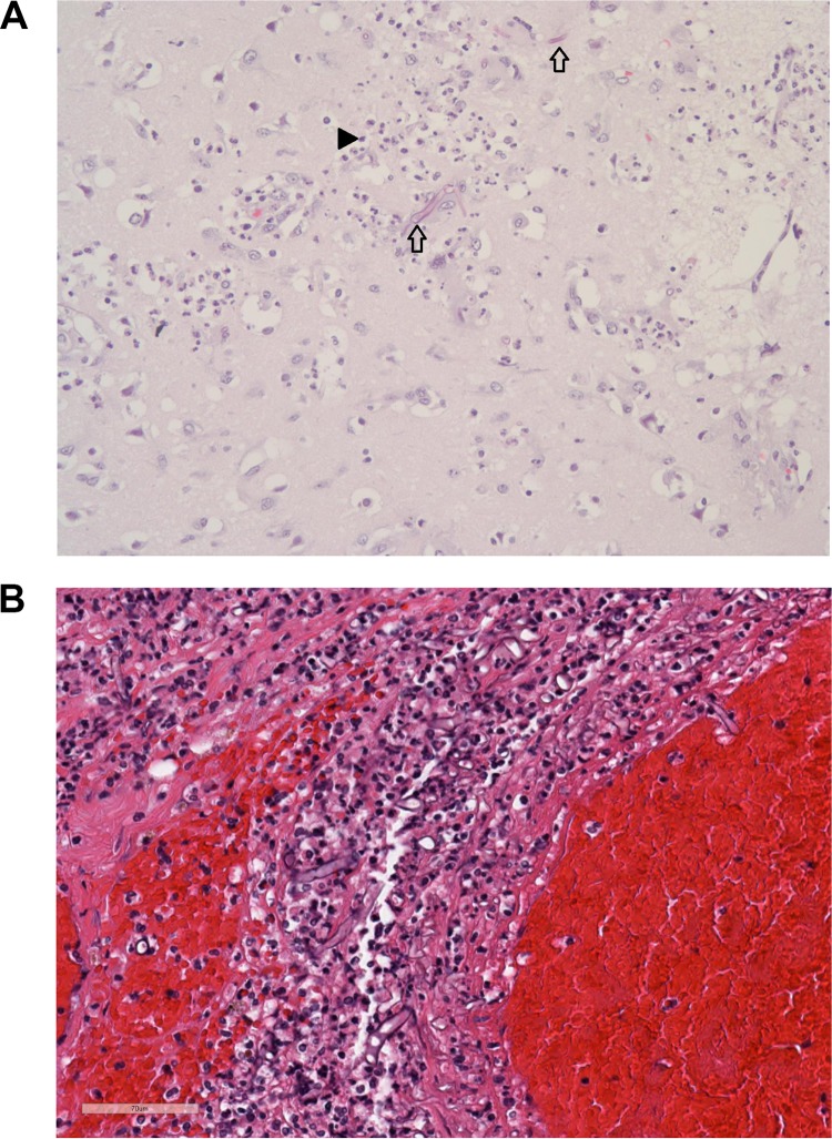 FIG 2