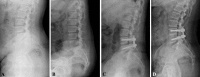 Fig. 2A–D