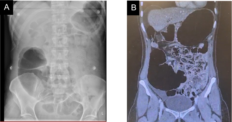 Fig. 6