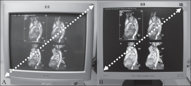Figure 1 (A,B)