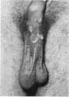 251
