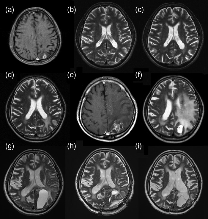 Figure 1: