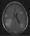 Fig 1.