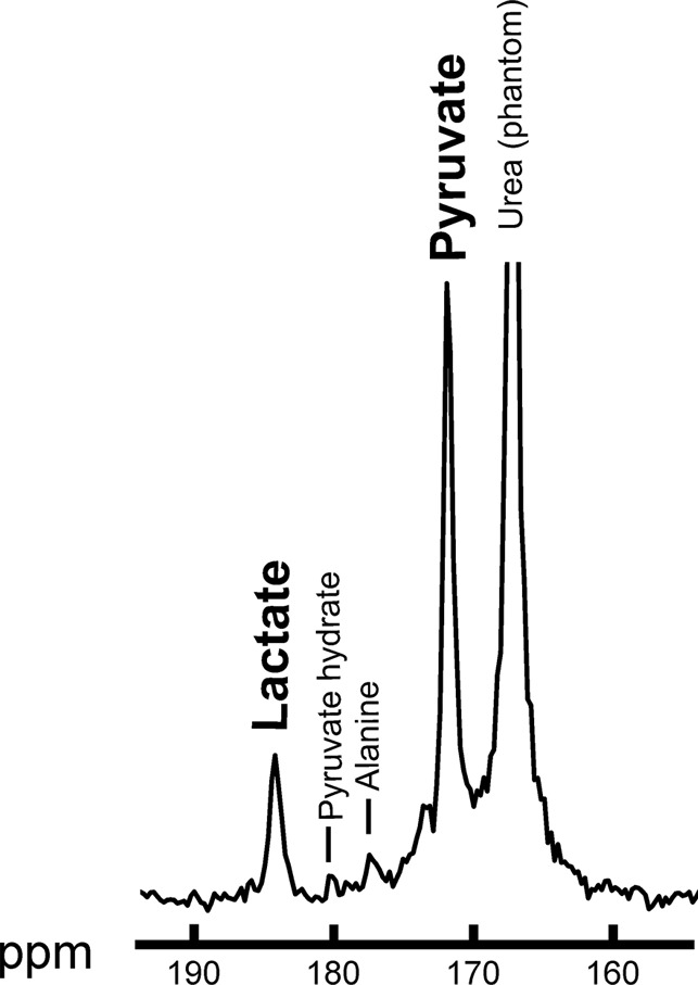 Summed 13C spectra over time after 13C-pyruvate bolus arrival in the breast. Summed spectra for (a) baseline and (b) after one cycle of neoadjuvant chemotherapy. ppm = parts per million.