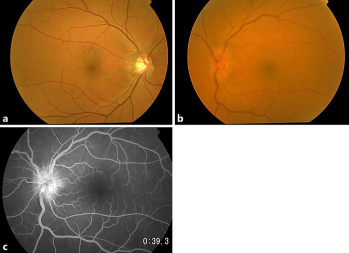 Fig. 2