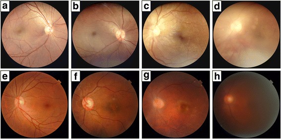 Fig. 4