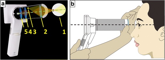 Fig. 2