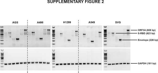 Supplementary figure 2