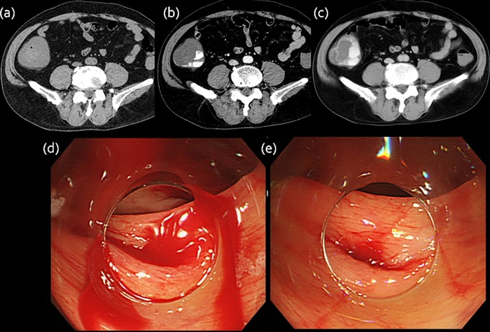 Fig 1