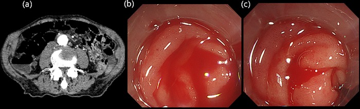 Fig 2