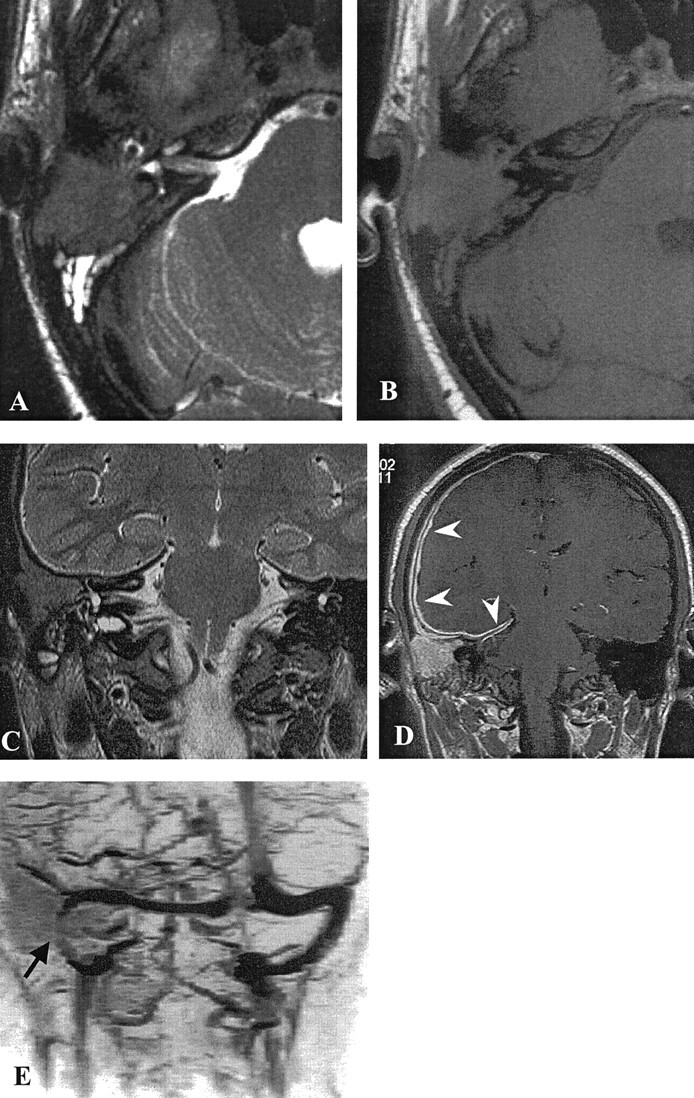 Fig 2.