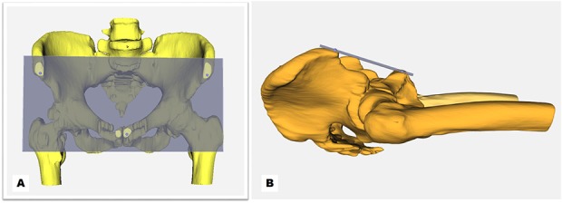 Fig. 1 A-B