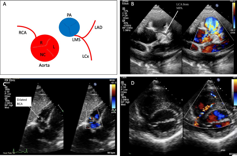 Fig. 2