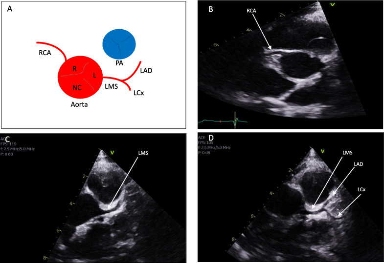 Fig. 1