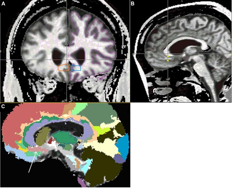 FIGURE 1