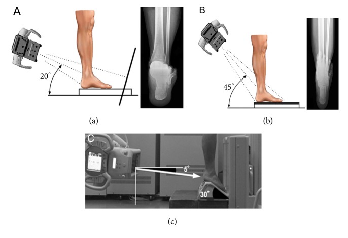 Compensatory Function of the Subtalar Joint for Lower Extremity ...