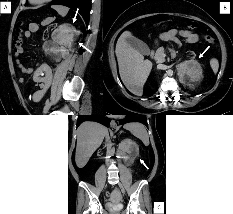 Fig. 1 –