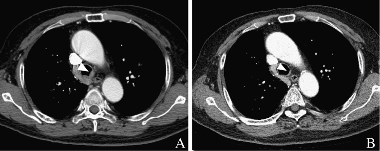 Fig. 2