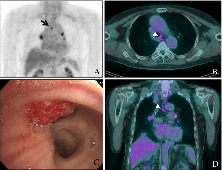 Fig. 1