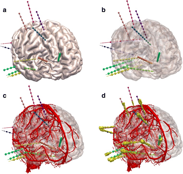 Fig. 2