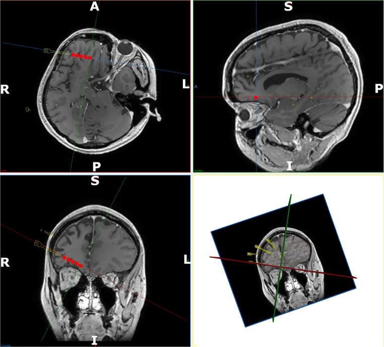 Fig. 3