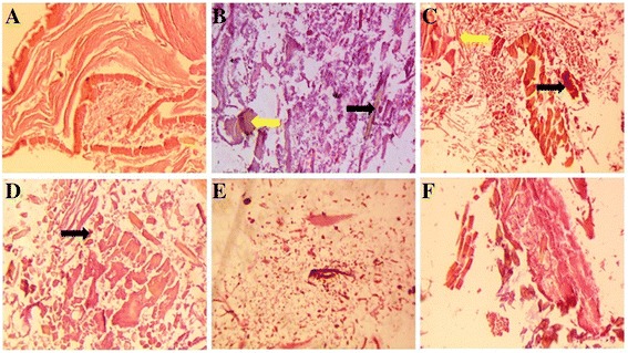 Fig. 12