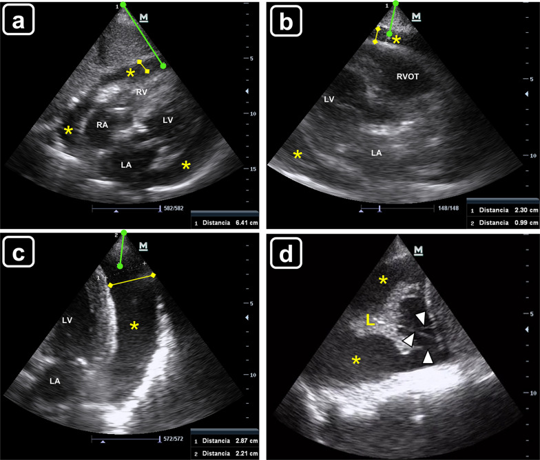 Fig. 1