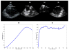Fig. 12
