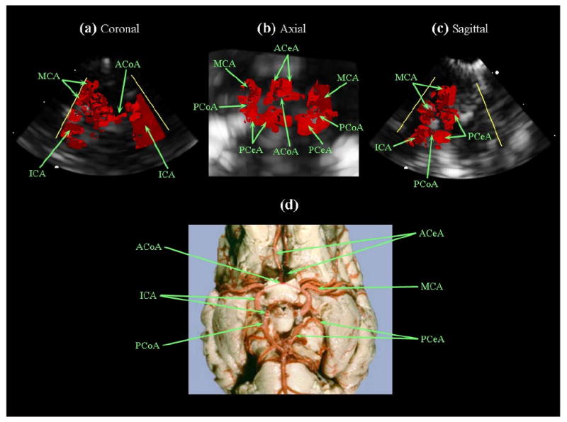 Fig. 11