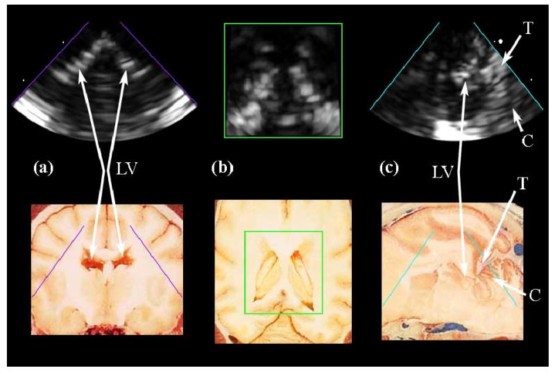 Fig. 10