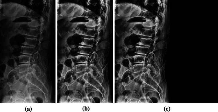 Fig. 1