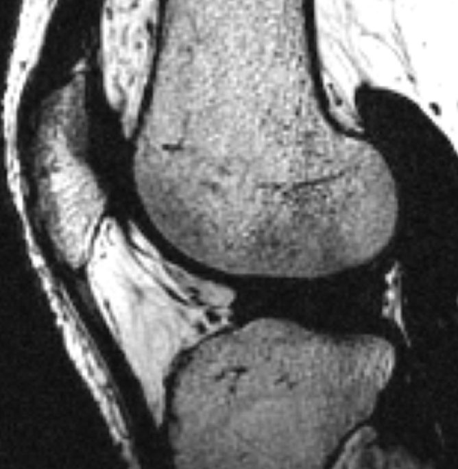 Figure 1c: