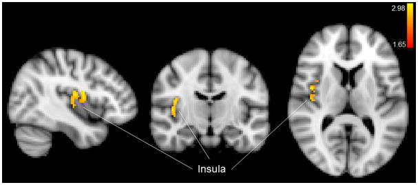 Figure 11