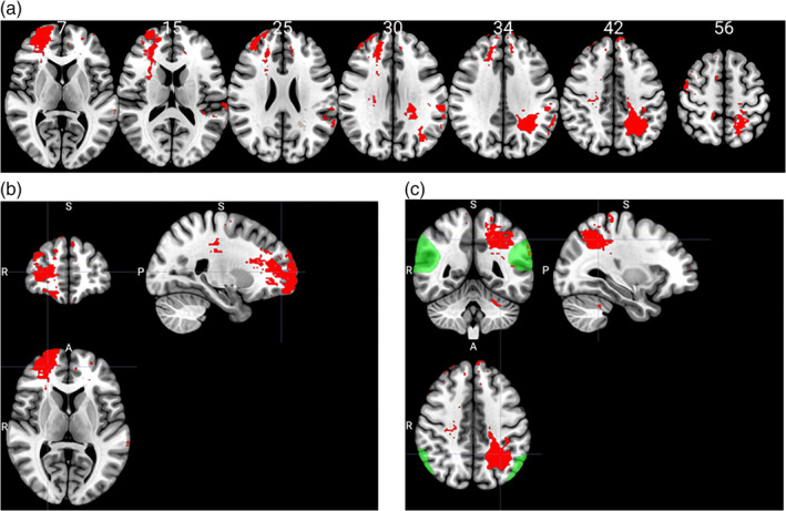 FIGURE 4