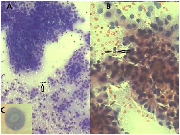 [Table/Fig-3]: