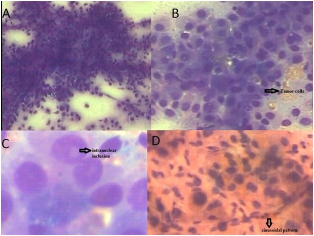 [Table/Fig-2]: