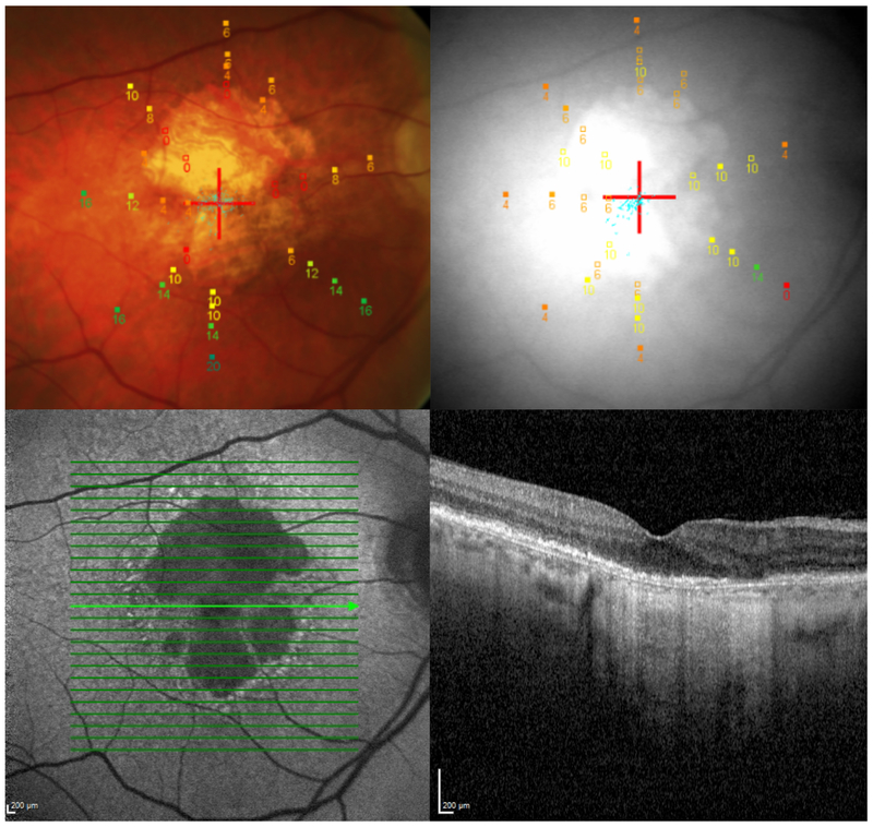 Fig. 1