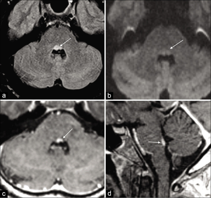 Figure 9: