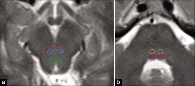 Figure 1: